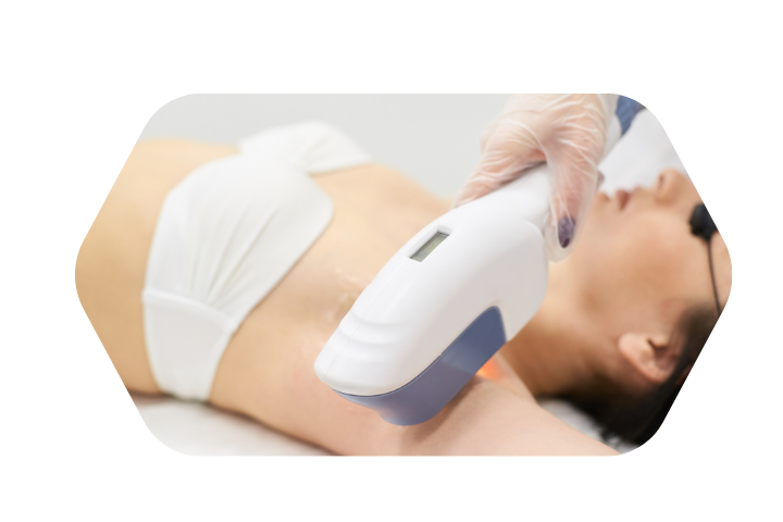 Buz Başlıklı Diot Lazer